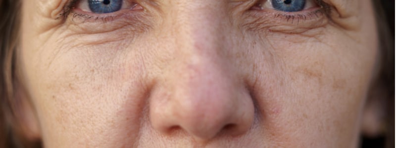 Woud Leidingen oppakken Doffe, vale, grauwe of vermoeide huid (rokershuid) - Schoonheidssalon  Artemystic Apeldoorn